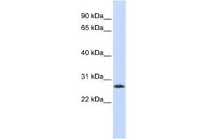 LSM12 antibody used at 1 ug/ml to detect target protein. (LSM12B anticorps)