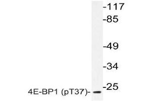 Western blot (WB) analyzes of p-4E-BP1 (pThr37) antibody in extracts from MDA-MB-435 EGF cells. (eIF4EBP1 anticorps  (pThr37))
