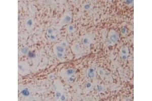 IHC-P analysis of Human Tissue, with DAB staining. (CPZ anticorps  (AA 425-652))