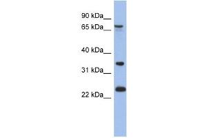 TBC1D25 antibody used at 1 ug/ml to detect target protein. (TBC1D25 anticorps  (N-Term))