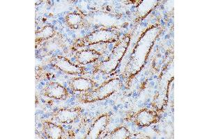 Immunohistochemistry of paraffin-embedded rat kidney using IDH3A antibody (ABIN7268029) at dilution of 1:100 (40x lens).