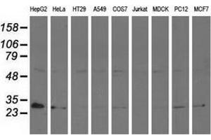 Western blot analysis of extracts (35 µg) from 9 different cell lines by using anti-AK3 monoclonal antibody. (Adenylate Kinase 3 anticorps)