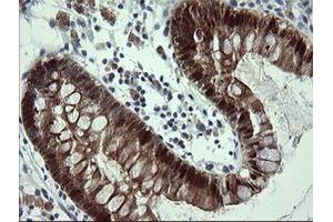 Image no. 5 for anti-Cytidine Monophosphate (UMP-CMP) Kinase 1, Cytosolic (CMPK1) antibody (ABIN1497544) (Cytidine Monophosphate (UMP-CMP) Kinase 1, Cytosolic (CMPK1) anticorps)