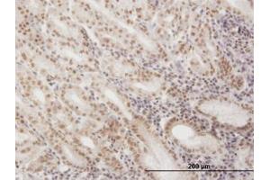 Image no. 1 for anti-Small Nuclear RNA Activating Complex, Polypeptide 4, 190kDa (SNAPC4) (AA 53-163) antibody (ABIN598934) (SNAPC4 anticorps  (AA 53-163))