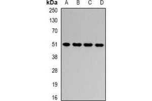 Western blot analysis of HADHB expression in HepG2 (A), Jurkat (B), mouse liver (C), rat liver (D) whole cell lysates.