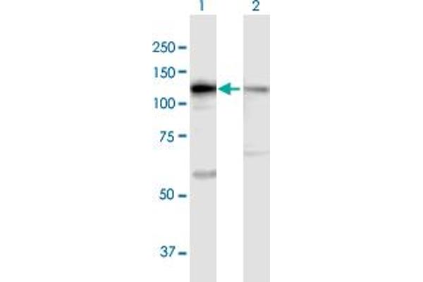DIS3 anticorps  (AA 1-958)