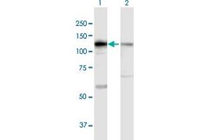 Western Blot analysis of DIS3 expression in transfected 293T cell line by DIS3 MaxPab polyclonal antibody. (DIS3 anticorps  (AA 1-958))