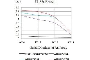 Black line: Control Antigen (100 ng),Purple line: Antigen (10 ng), Blue line: Antigen (50 ng), Red line:Antigen (100 ng)