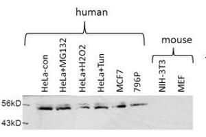 USP30 antibody - middle region  validated by WB using Hela cell lysate (Usp30 anticorps  (Middle Region))