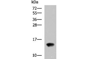 Western blot analysis of Rat kidney tissue lysate using FAM19A4 Polyclonal Antibody at dilution of 1:650