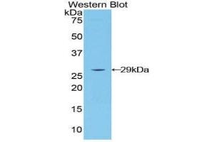 Western Blotting (WB) image for anti-Lymphocyte-Activation Gene 3 (LAG3) (AA 274-504) antibody (ABIN1859591) (LAG3 anticorps  (AA 274-504))