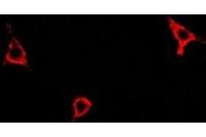 Immunofluorescent analysis of Asparagine Synthetase staining in A549 cells. (Asparagine Synthetase anticorps)