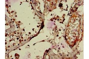 Immunohistochemistry of paraffin-embedded human testis tissue using ABIN7151134 at dilution of 1:100 (RNF126 anticorps  (AA 39-225))