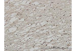 Immunoperoxidase of monoclonal antibody to FOXC2 on formalin-fixed paraffin-embedded human lateral ventricle wall.