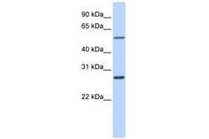 Image no. 1 for anti-Ring Finger Protein 217 (RNF217) (C-Term) antibody (ABIN6740824) (RNF217 anticorps  (C-Term))