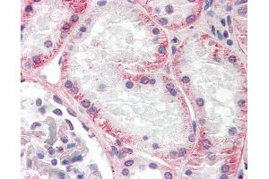 Anti-KLHL1 / MRP2 antibody IHC staining of human kidney.