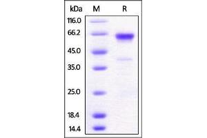 Mouse 4-1BB, Fc Tag on SDS-PAGE under reducing (R) condition.