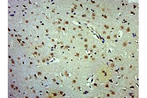 Paraformaldehyde-fixed, paraffin embedded Rat brain; Antigen retrieval by boiling in sodium citrate buffer (pH6. (APC1 anticorps  (pSer377))