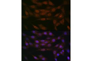 Immunofluorescence analysis of NIH-3T3 cells using Emerin/EMD Rabbit mAb (ABIN7266933) at dilution of 1:100 (40x lens). (Emerin anticorps)