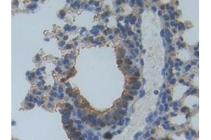 Detection of MYO1A in Mouse Lung Tissue using Polyclonal Antibody to Myosin IA (MYO1A) (Myosin IA anticorps  (AA 783-1043))