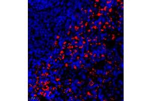 Immunofluorescence of paraffin embedded rat spleen using Thymosin (ABIN7075306) at dilution of 1:1500 (400x lens)