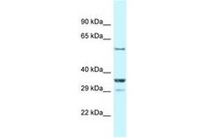 Image no. 1 for anti-Cas-Br-M (Murine) Ecotropic Retroviral Transforming Sequence-Like 1 (CBLL1) (AA 413-462) antibody (ABIN6747715) (CBLL1 anticorps  (AA 413-462))