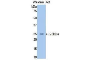Western Blotting (WB) image for anti-Kininogen (High Molecular Weight) (AA 225-407) antibody (ABIN1859236) (Kininogen (HMW) anticorps  (AA 225-407))