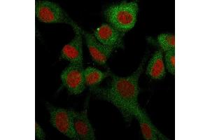 Immunofluorescence staining of U87MG cells using CD73 Mouse Monoclonal Antibody (NT5E/2503) followed by goat anti-Mouse IgG conjugated to CF488 (green).