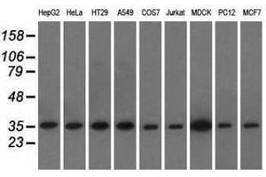 Image no. 1 for anti-Eukaryotic Translation Initiation Factor 2 Subunit 1 (EIF2S1) antibody (ABIN1497970)