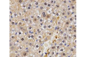 Immunohistochemistry of paraffin-embedded Rat liver using HSF2 Polyclonal Antibody at dilution of 1:200 (40x lens). (HSF2 anticorps)