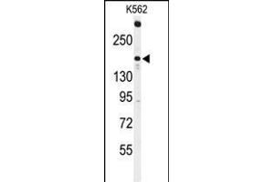 Western blot analysis of ACK1 Antibody (N-term) (ABIN392082 and ABIN2841841) in K562 cell line lysates (35 μg/lane). (TNK2 anticorps  (N-Term))