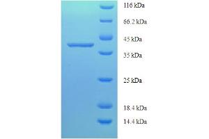 SDS-PAGE (SDS) image for La Ribonucleoprotein Domain Family, Member 1B (LARP1B) (AA 1-201), (full length) protein (His-SUMO Tag) (ABIN5711421)