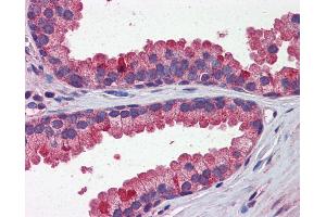 Immunohistochemistry (IHC) image for anti-Wingless-Type MMTV Integration Site Family, Member 3A (WNT3A) (N-Term) antibody (ABIN2787841)