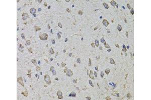 Immunohistochemistry of paraffin-embedded Mouse brain using ARHGEF3 Polyclonal Antibody at dilution of 1:100 (40x lens). (ARHGEF3 anticorps)