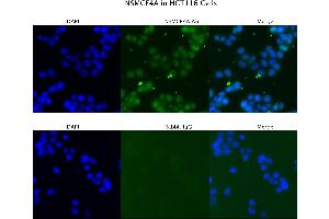 Sample Type : HCT116  Primary Antibody Dilution: 4 ug/ml  Secondary Antibody : Anti-rabbit Alexa 546  Secondary Antibody Dilution: 2 ug/ml  Gene Name : NSMCE4A (NSMCE4A anticorps  (C-Term))