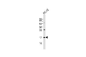 Anti-SFT2D2 Antibody at 1:1000 dilution + PC-12 whole cell lysates Lysates/proteins at 20 μg per lane. (SFT2D2 anticorps)