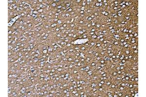 IHC analysis of SYP using anti-SYP antibody (ABIN7603120). (Synaptophysin anticorps  (N-Term))