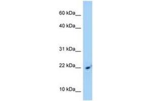 Image no. 1 for anti-Signal Recognition Particle 14kDa (Homologous Alu RNA Binding Protein) (SRP14) (AA 81-130) antibody (ABIN6748137) (SRP14 anticorps  (AA 81-130))