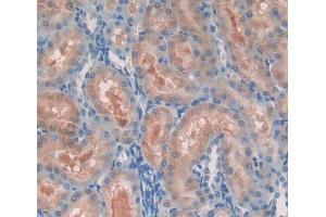 Used in DAB staining on fromalin fixed paraffin- embedded Kidney tissue (PCM1 anticorps  (AA 15-210))