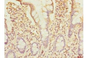 Immunohistochemistry of paraffin-embedded human small intestine tissue using ABIN7171247 at dilution of 1:100