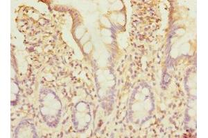 Immunohistochemistry of paraffin-embedded human small intestine tissue using ABIN7171247 at dilution of 1:100 (Syntaxin 7 anticorps  (AA 1-170))