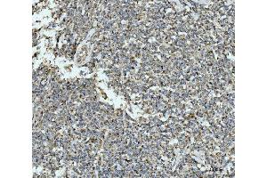 IHC analysis of ECSIT using anti-ECSIT antibody (ABIN7602543).