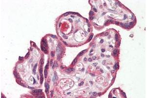 Human Placenta: Formalin-Fixed, Paraffin-Embedded (FFPE) (RILPL2 anticorps  (Internal Region))