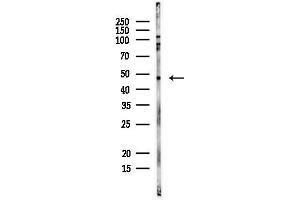 anti-Poly A Binding Protein Nuclear 1 (PABPN1) (C-Term) antibody