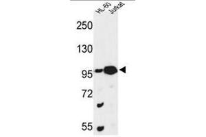 Western blot analysis of CSPP1 Antibody (N-term) in HL-60, Jurkat cell line lysates (35µg/lane).