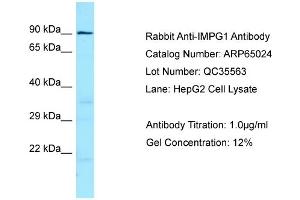 Western Blotting (WB) image for anti-Interphotoreceptor Matrix Proteoglycan 1 (IMPG1) (C-Term) antibody (ABIN2790023) (IMPG1 anticorps  (C-Term))