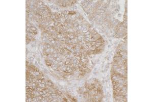 Immunohistochemistry (IHC) image for anti-Ribosomal Protein S3A (RPS3A) (AA 1-50) antibody (ABIN7455060) (RPS3A anticorps  (AA 1-50))