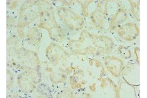 Immunohistochemistry of paraffin-embedded human kidney tissue using ABIN7173555 at dilution of 1:100 (TMOD3 anticorps  (AA 1-352))