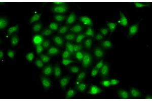 Immunofluorescence analysis of A-549 cells using COPS2 Polyclonal Antibody (COPS2 anticorps)