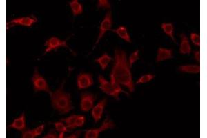 ABIN6275247 staining HeLa by IF/ICC. (TOMM20 anticorps  (Internal Region))